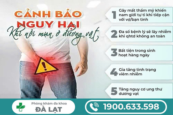 Hình ảnh minh họa